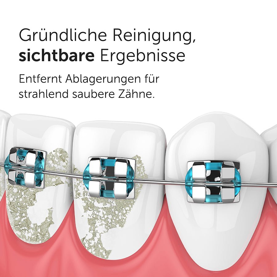 Periodontal Ersatzdüsen Munddusche Waterflow - WonderSmile GmbH