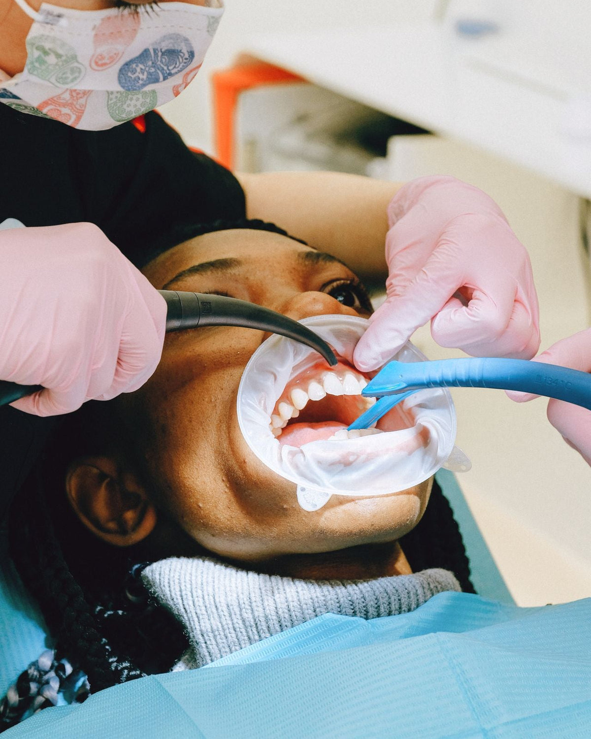 300 bis 600 Euro für Profi Bleaching und der Alltag holt die Flecken zurück